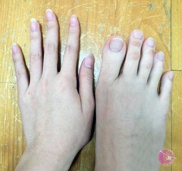 toes-like-fingers-3
