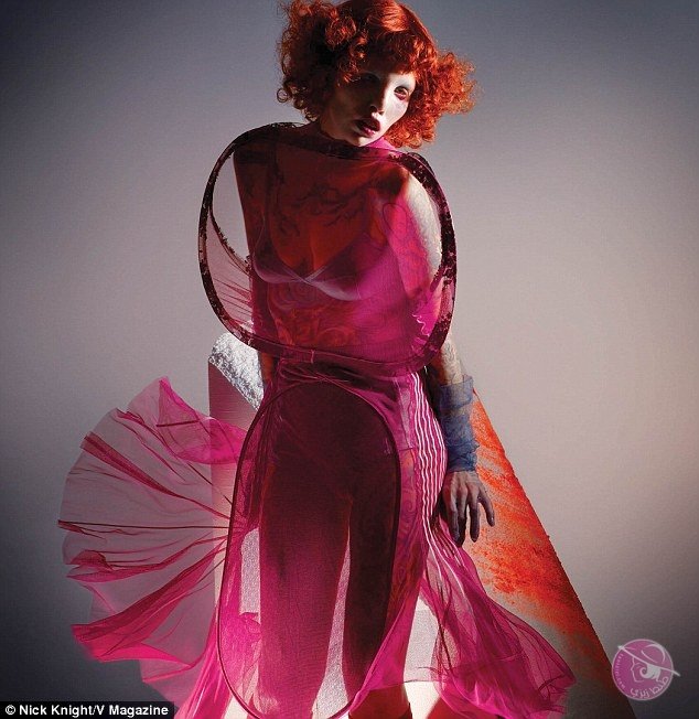 3E1E1DF500000578-4298886-The_Seattle_based_model_was_born_with_Schmid_Fraccaro_syndrome_o-a-4_1489097818922